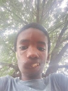 Scars still haunt victim