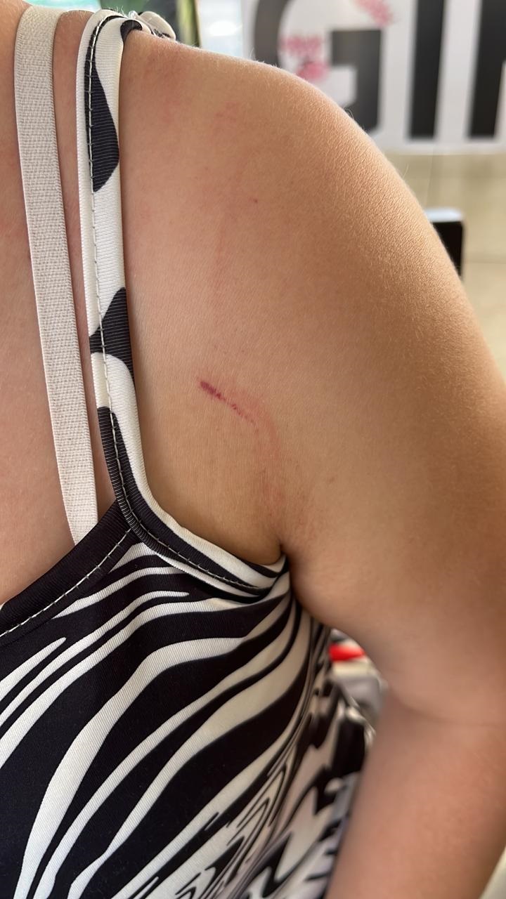 One of the finalists was attacked while fleeing the scene.. The entrants were rehearsing for the function that