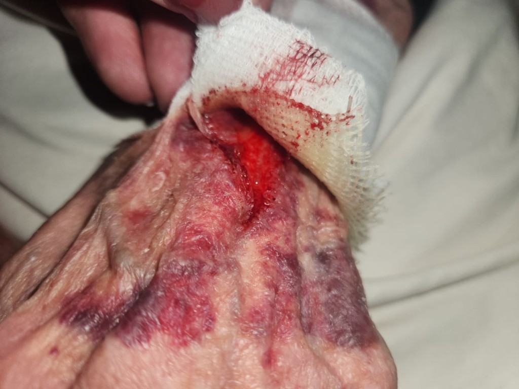 The emotional scenes playing off in the videos are exacerbated by photos of extremely bruised hands, bleeding lips from the duct tape, and bruises, scratches and scrapes to the face.