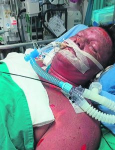 Wellington-skeepskaptein veg om sy lewe ná katamaran-ontploffing in Thailand