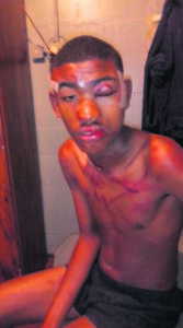 Seun ly 2 jaar later nog