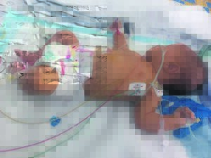 Baba Pike kort hulp vir operasie