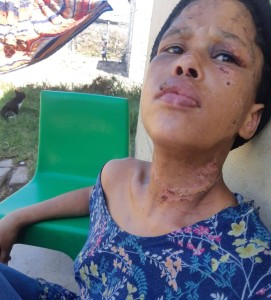 Jong vrou weg ná sy aanrandingsklag  by polisie gaan lê