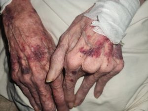 Will the six accused in the assault of a frail elderly woman get bail on Friday?