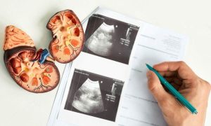 Chronic kidney disease increases risk of cardiovascular death
