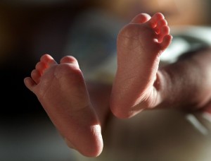 One of separated conjoined twins dies from organ failure