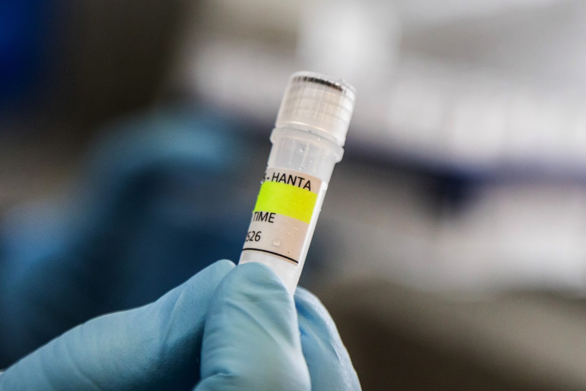 A scientist from the Malbrán Institute holding a container used to diagnose the Andes hantavirus. Photo: AFP/Argentina's Health Ministry