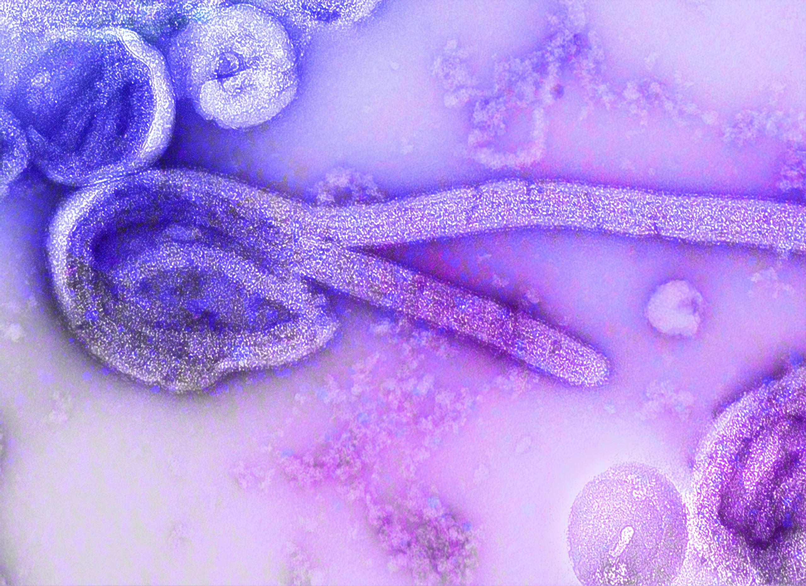 This is an electron microscopic image of the 1976 isolate of Ebola virus. PHOTO: CDC