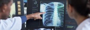 New research project aims to transform tuberculosis diagnosis with AI-powered technology