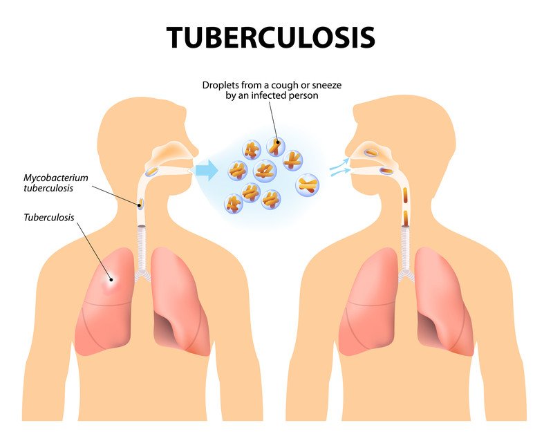 TB testing