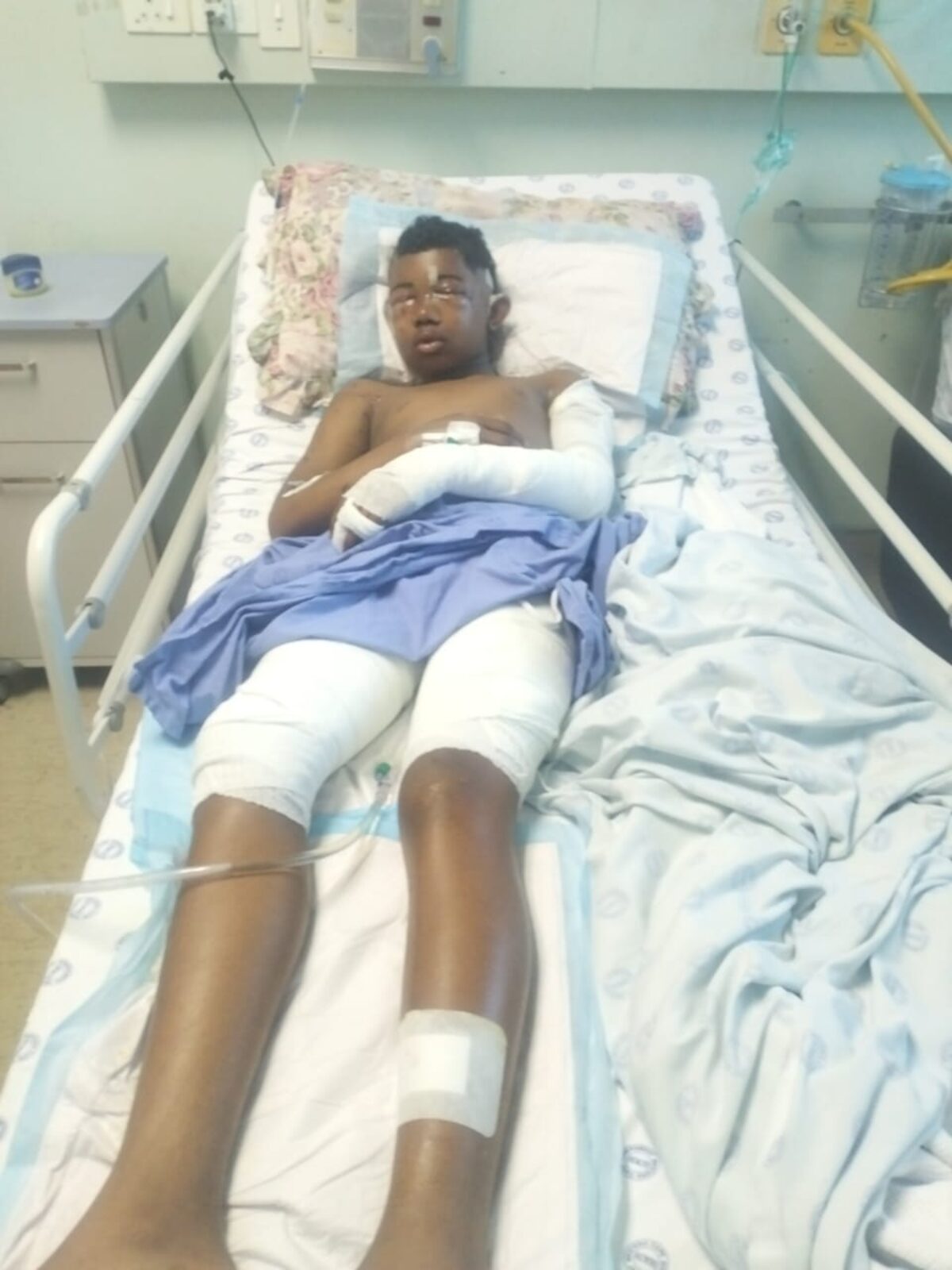 Arrest after dog attack on Sir Lowry’s Pass teenager