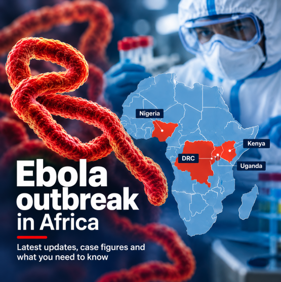 Ebola